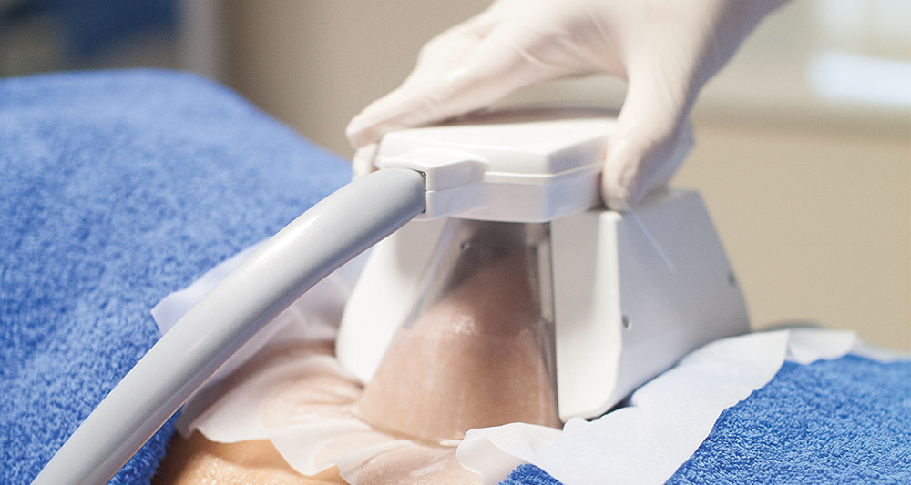 How Fat Freezing and HIFU Work Together? 2 Multiple Areas in One Session HIFU and Fat Freezing Brentford