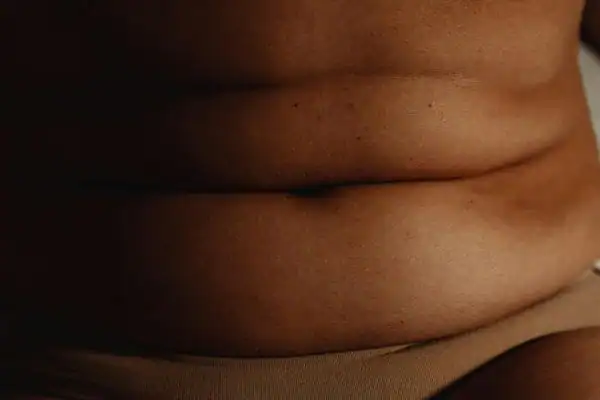 The Hidden Connection: How Stress Shapes Your Fitness and Body Composition 3 image of what stress can do on the stomach area and how Lipo 360 Brentford can help to change your body shape.