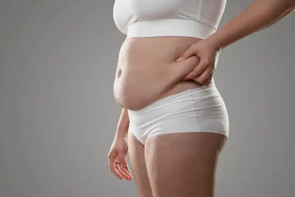 Image of stress belly Brentford How Lipo 360 can help manage your symptoms